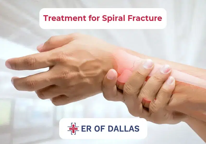 Treatment for Spiral Fracture - ER of Dallas