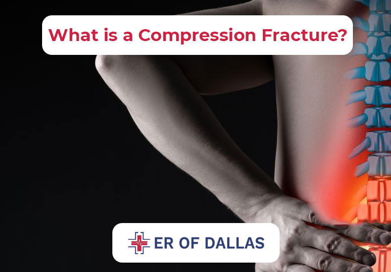 What is a Compression Fracture - ER of Dallas