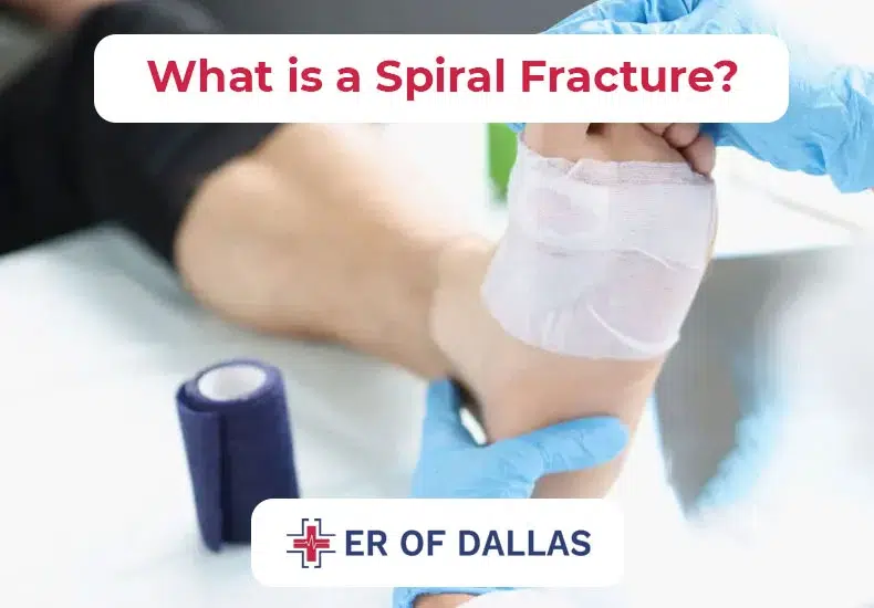 What is a Spiral Fracture - ER of Dallas