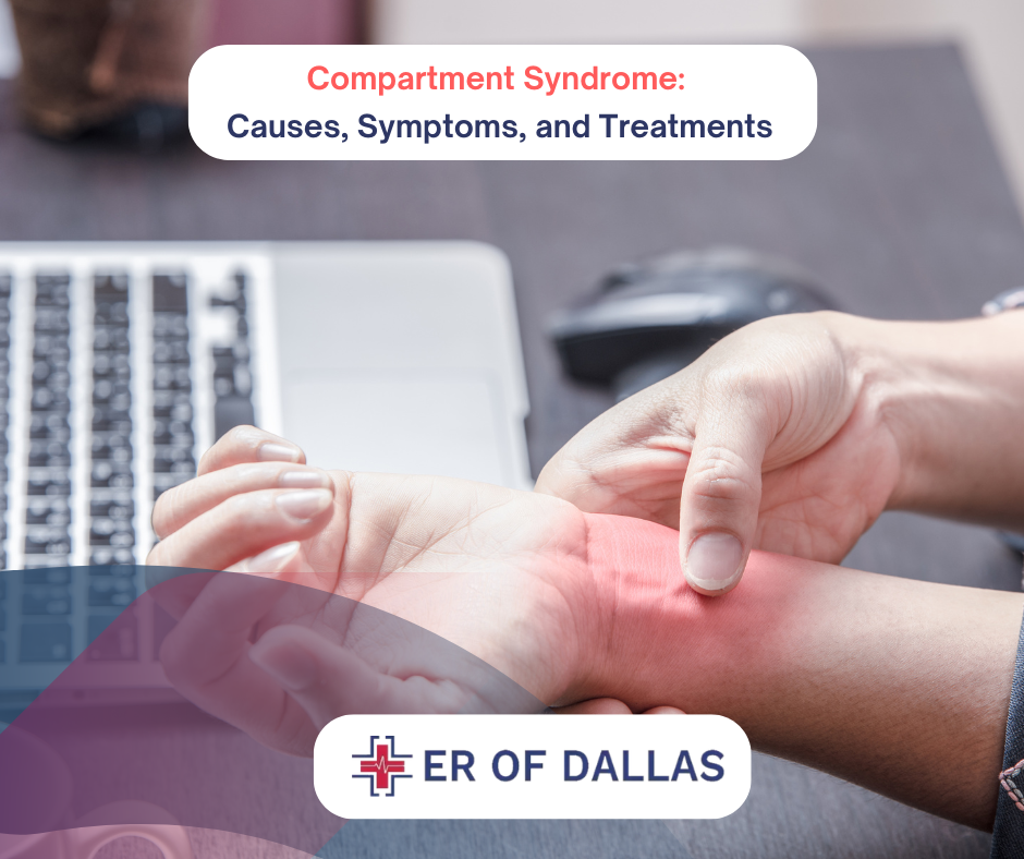 Compartment Syndrome: Causes, Symptoms, and Treatments at ER of Dallas