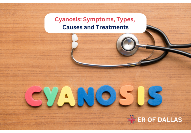 Cyanosis Symptoms, Types, Causes and Treatments at ER of Dallas