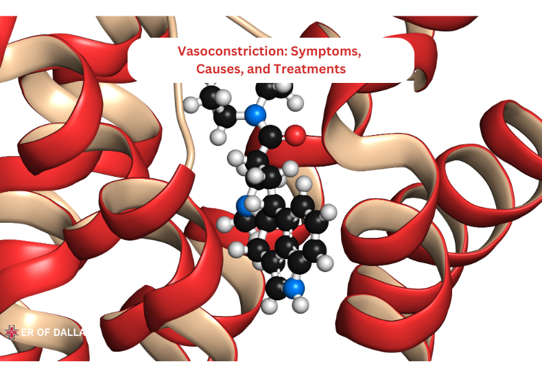 Vasoconstriction Symptoms, Causes, and Treatments - ER of Dallas