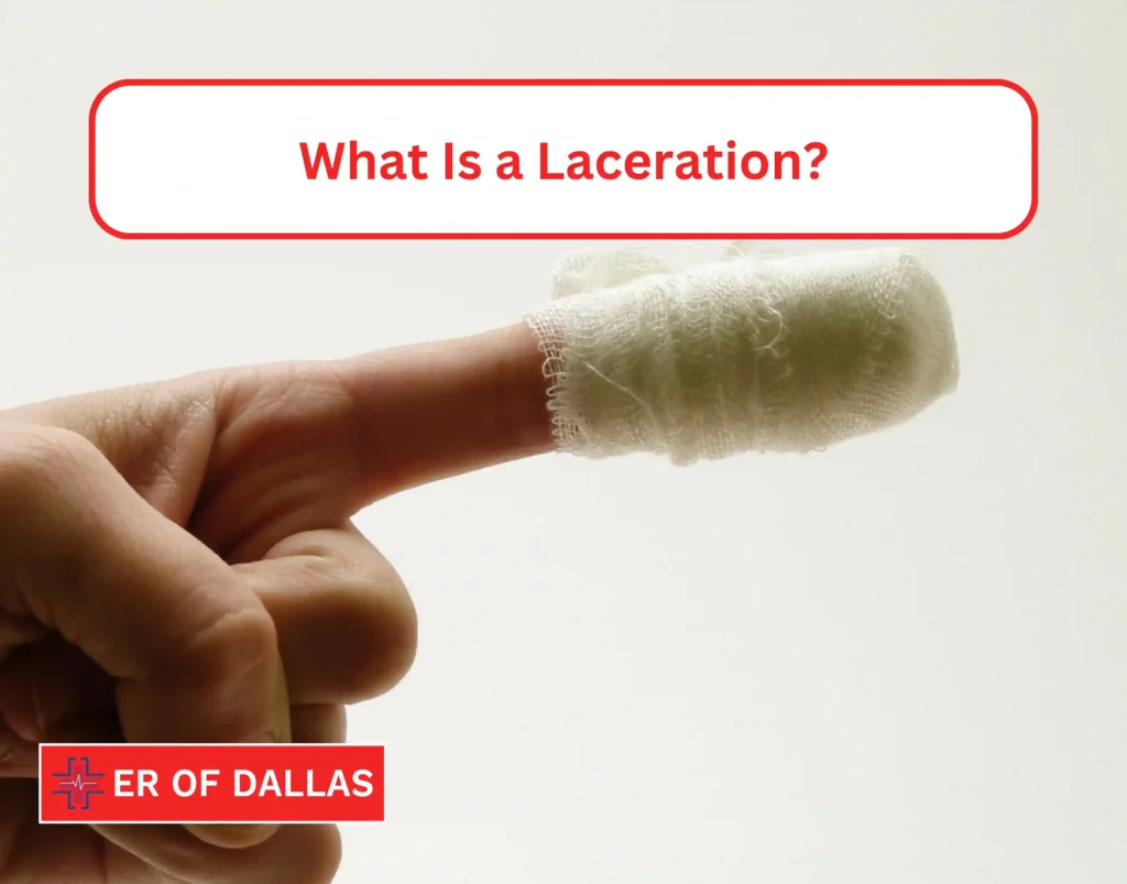 What Is a Laceration