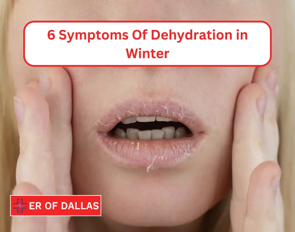 6 Symptoms of Dehydration in Winter