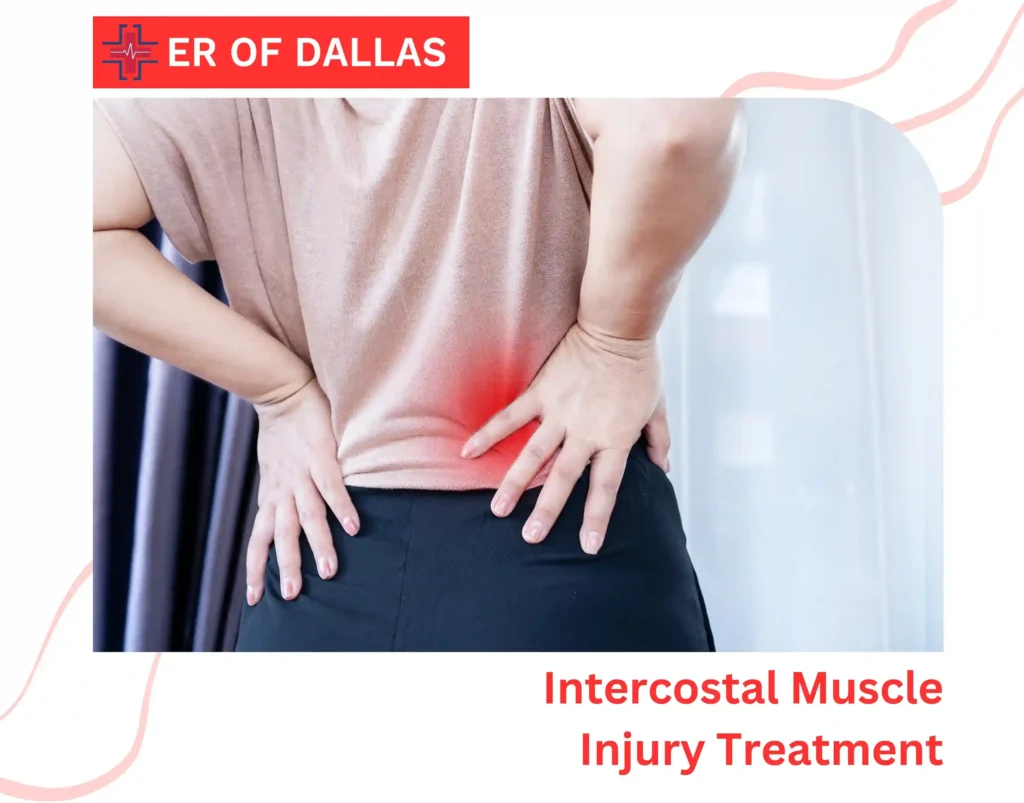 Intercostal Muscle Injury Treatment