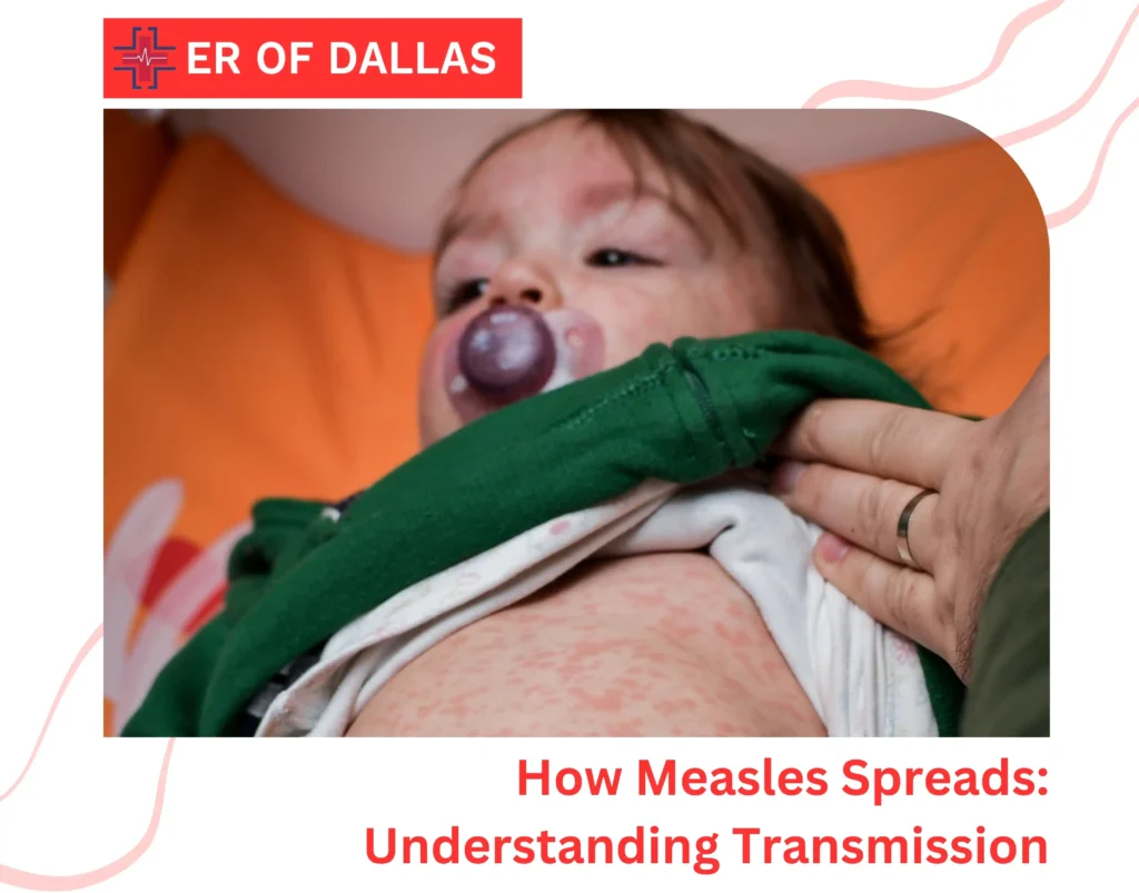 How Measles Spreads Understanding Transmission