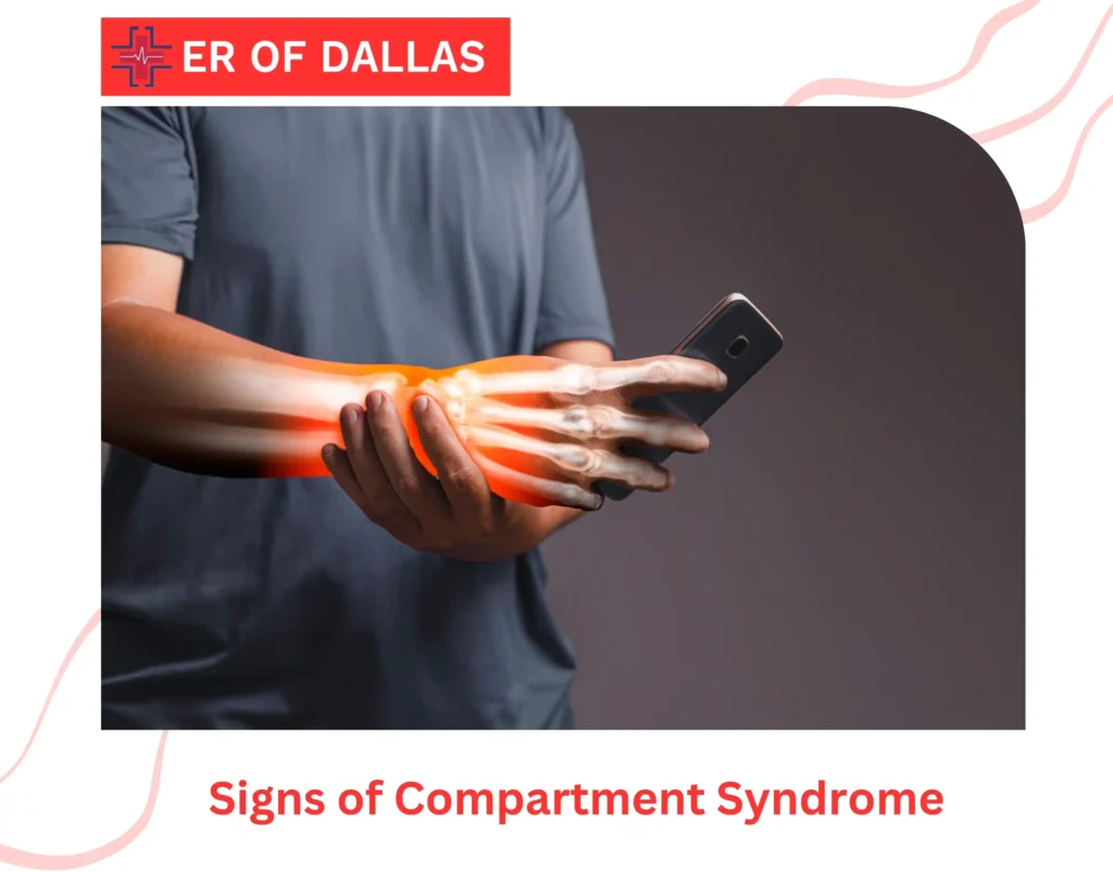Signs of Compartment Syndrome