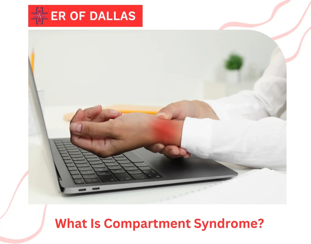 What Is Compartment Syndrome