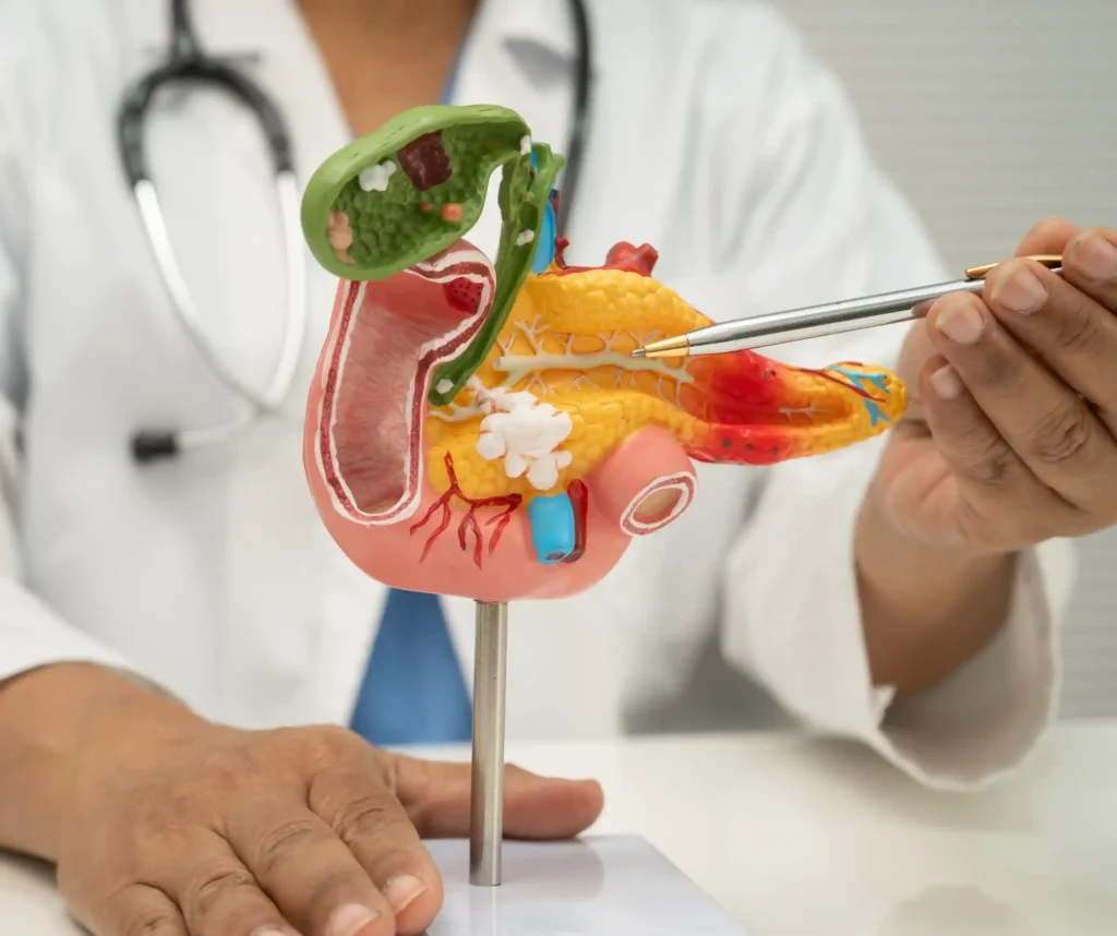 Pancreatitis Emergency Care in Dallas, TX