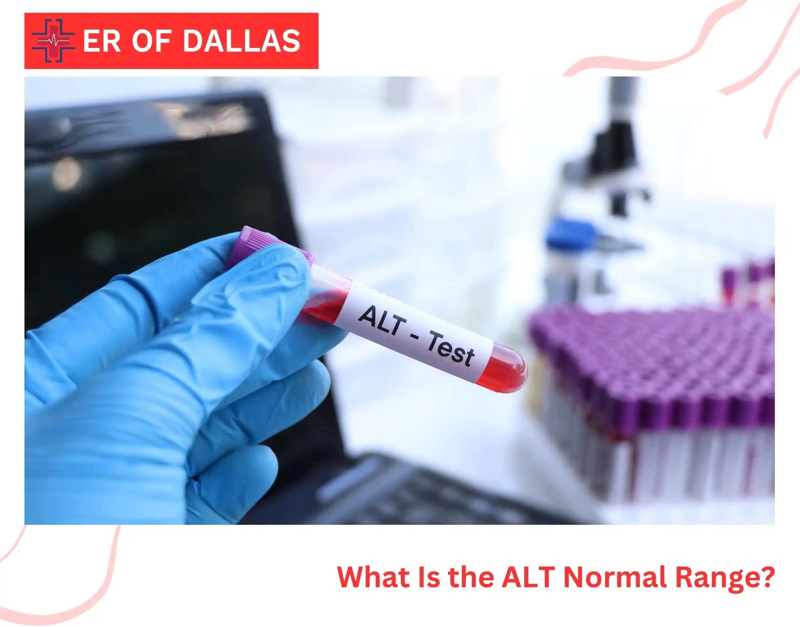 What Does High SGPT Indicate? Your Lab Results Decoded