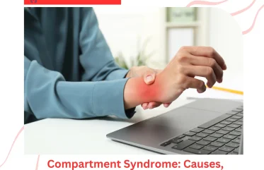 Compartment Syndrome: Causes, Symptoms, and Treatments