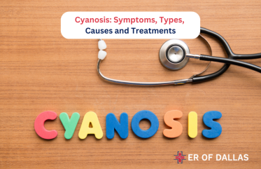 Cyanosis Symptoms, Types, Causes and Treatments at ER of Dallas