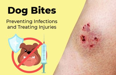 Dog Bites Preventing Infections and Treating Injuries Featured